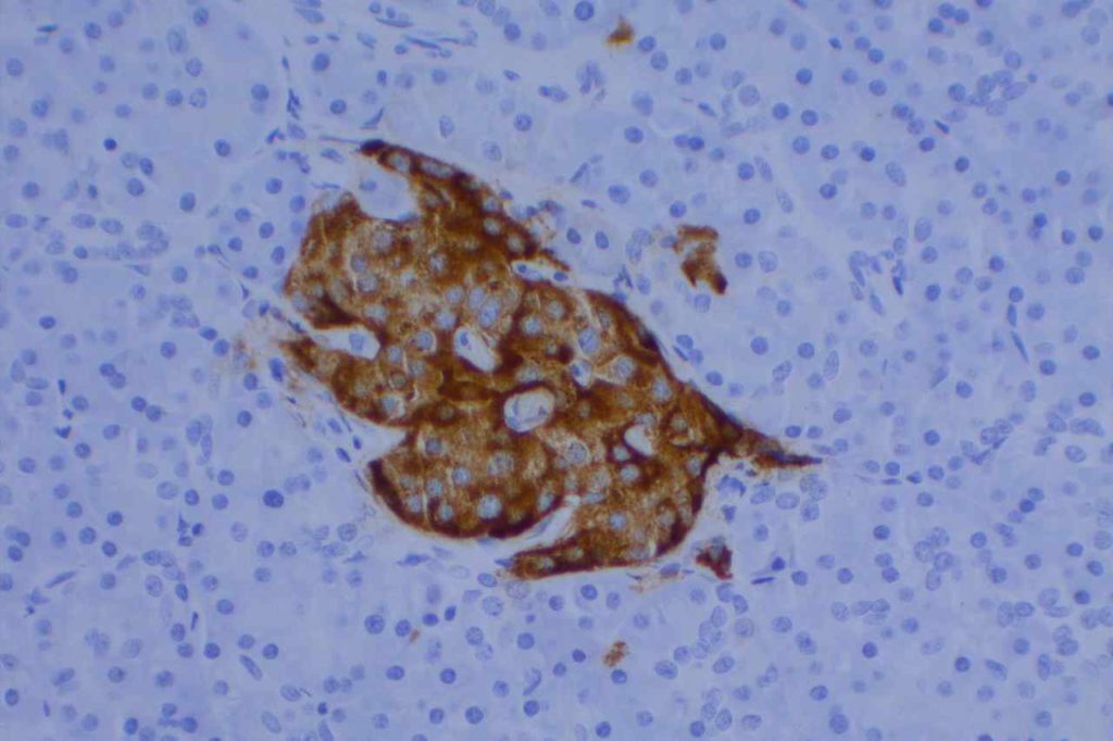 Chromogranin A - Pancreas Islet Cells