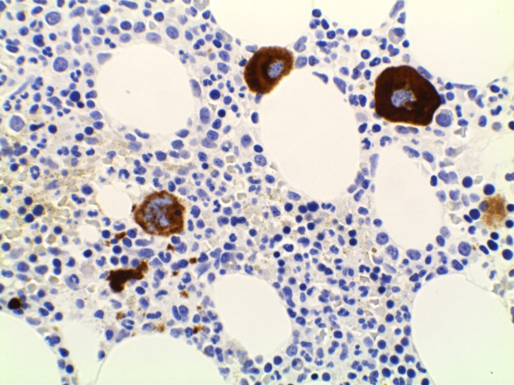 CD61 - Megakaryocytes
