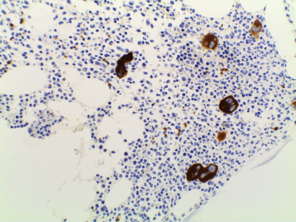 CD61 - Megakaryocytes