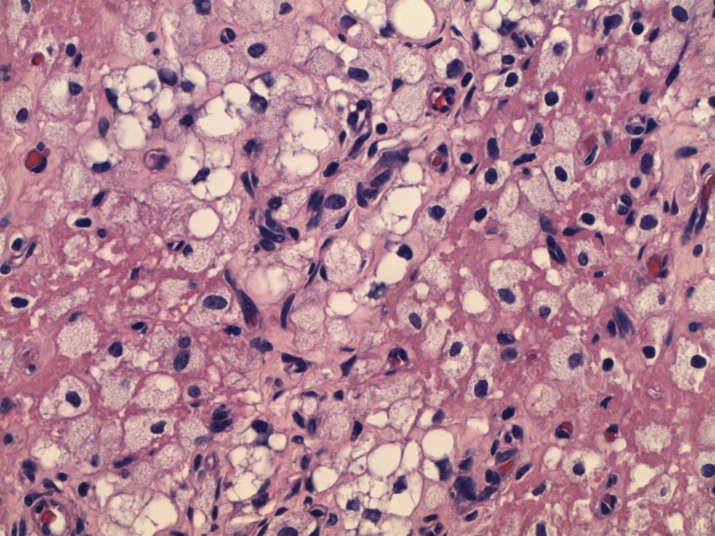 CD68 - Ovary histiocytes