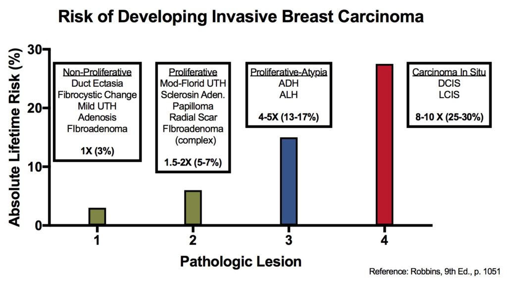 Breast Cancer Risk Chart