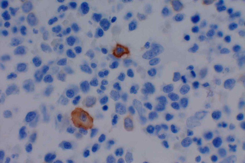 CD117 - Mast Cells